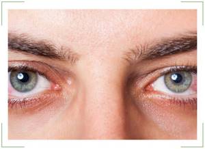 Мерцание и вспышки в глазах при шейном остеохондрозе: причины и распространенные симптомы нарушения, диагностика, терапевтическое лечение и профилактика