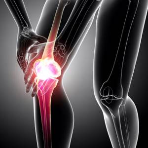 Тендинит коленного сустава: причины и факторы развития болезни, стадии заболевания и его диагностика, консервативные и оперативные методы терапии