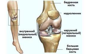 Разрыв медиального мениска коленного сустава: характерные признаки и причины травмы, стандартные этапы реабилитации и лечения, сроки восстановления