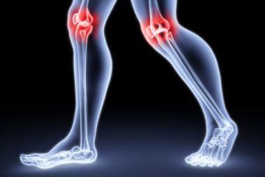 Остеохондроз коленного сустава: причины и признаки развития патологии, медикаментозное и хирургическое лечение, физиотерапевтические процедуры и народные средства