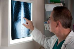 Какой врач лечит остеопороз костей и позвоночника: описание заболевания и его симптомы, методики диагностики и лечения, выбор специалистов и цены на их услуги