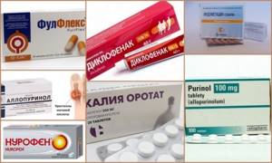 Лечение подагры препаратами, выводящими мочевую кислоту: основные принципы терапии, обзор медикаментозных средств, показания и противопоказания