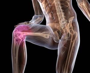 Нестабильность коленного сустава: причины и классификация патологии, специфические симптомы, методы диагностики и лечения, профилактика и возможные осложнения