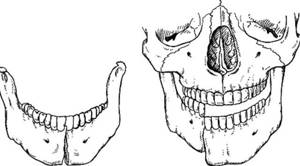 Болит челюсть: перелом костей и его виды, первая помощь, алгоритм действий, когда нужно обращаться к врачу, лечение и профилактика