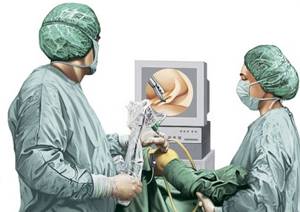 Артроскопия плечевого сустава: показания к операции и ее преимущества, подготовительные процедуры и техника проведения, противопоказания и возможные осложнения, цена и отзывы
