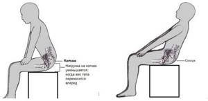 Боль в копчике при сидении: классификация болевых ощущений и способы лечения, диагностика проблемы и когда необходимо обращаться к врачу