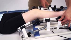 Аппарат Артромот для разработки сустава: когда назначается, виды, правила применения, показания и противопоказания к использованию artromot, отзывы пациентов