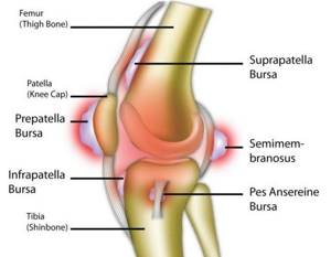 Бурсит коленного сустава: признаки и причины патологии, описание недуга и способы терапии, методы диагностики и прогноз на выздоровление