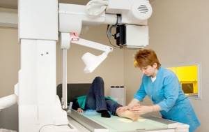 Рентген голеностопного сустава: показания и противопоказания к исследованию, подготовительный этап и техника проведения процедуры, информативность методики