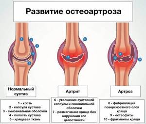 Рентген коленного сустава: что показывает диагностика, как проводиться, для чего назначается процедура