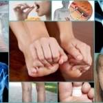 Немеет средний палец: физиологические и патологические причины онемения, современные и народные методы лечения, профилактические мероприятия