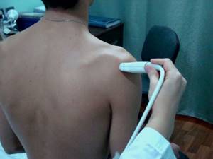 УЗИ плечевого сустава: что может показать, показания к проведению процедуры и суть метода, выявляемые патологии, цена