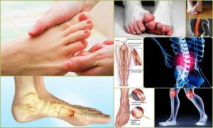 Немеют пальцы на ногах: основные причины, диагностика заболевания, лечебные меры, аптечные и народные средства, профилактика