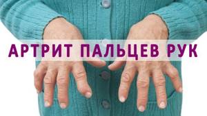 Болит кисть руки: консервативный подход и показания для вмешательства, возможные заболевания и применение медикаментов, народные способы снятия воспаления