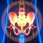 Перелом подвздошной кости: классификация и причины повреждения, методы диагностики и правила оказания первой помощи, способы лечения и этапы реабилитации