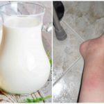 Молочные продукты и подагра: польза и вред, влияние молока на течение недуга и сыр в ежедневном рационе, допустимые дозы и противопоказания к употреблению