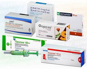 Препараты для лечения остеопороза: основные принципы лечения и обзор медикаментов, виды лекарств и формы выпуска, стоимость в аптеке