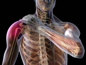 Остеохондроз плечевого сустава: чем опасно заболевание, как проявляется, диагностика, основные методы лечения медикаментозными препаратами и народными средствами
