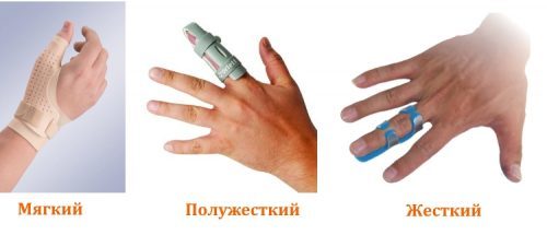 Выбор ортеза на палец руки: виды и применение, показания, как выбрать фиксирующее приспособление по материалу, производителю, размеру и цене