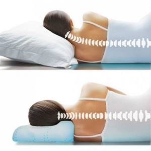 Как правильно спать при сколиозе: правила выбора ортопедического матраса и подушки, рекомендуемые позы для сна