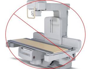 Рентген грудного отдела позвоночника: для чего назначается, что показывает, как проводится диагностика, противопоказания и особенности метода