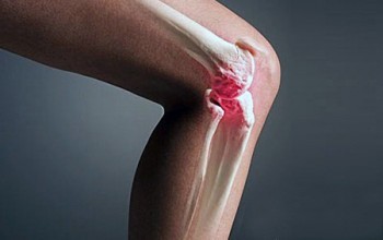 Гемартроз коленного сустава: первая помощь и последующая терапия, симптоматика и причины патологии, диагностика и профилактика недуга