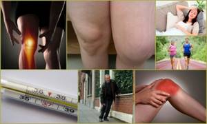 Контрактура коленного сустава: причины развития и классификация, симптомы при разных формах патологии, диагностика, методы лечения и реабилитации