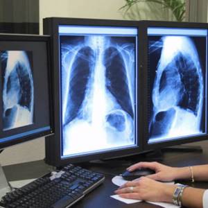 Рентген грудного отдела позвоночника: для чего назначается, что показывает, как проводится диагностика, противопоказания и особенности метода