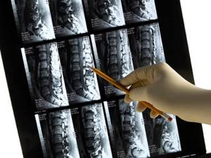 МРТ позвоночника: виды обследования, показания и противопоказания к назначению, подготовка и механизм проведения диагностики, эффективность и стоимость процедуры