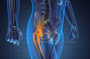 Болит нога от бедра до колена: главные причины, симптомы, диагностика заболевания, лечебные и профилактические меры