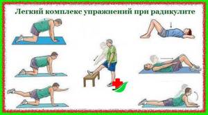 Упражнения при радикулите поясничного отдела: лечебная гимнастика и правила тренировок, противопоказания и примеры движений