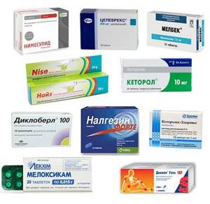 Нестероидные противовоспалительные средства при остеохондрозе: список самых эффективных препаратов и правила приема, как действуют и кому подходят, противопоказания и цена в аптеке