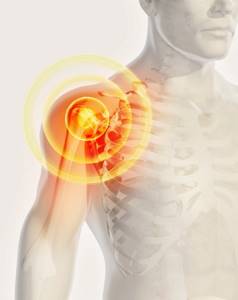 Бурсит плечевого сустава: причины возникновения и клиническая картина, диагностика заболевания и способы терапии, как предупредить недуг