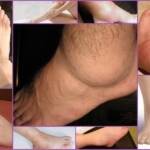 Синовит голеностопного сустава: разновидности патологии и симптомы, медикаментозная и народная терапия, прогноз и профилактика