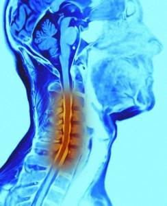Электромассажер для шеи и плеч при остеохондрозе: описание процедуры лечения, плюсы и минусы, секреты выбора и противопоказания