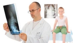 Рентген руки: эффективные методы исследования для постановки диагноза, что показывает и как проходит обследование, кому противопоказана диагностика