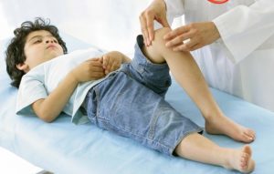 Дисплазия коленного сустава: определение и причины патологии, симптомы, диагностика у детей и взрослых, лечение ортопедическими конструкциями и хирургическим вмешательством