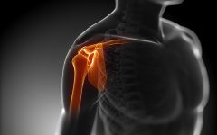Разрыв связок плечевого сустава: как лечить, симптоматика и причины, первичная терапия и последующее лечение, реабилитация после травмы