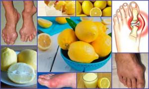 Цитрусовые при подагре: можно ли есть и правила употребления в пищу, влияние лимонной кислоты на болезнь, лечебные рецепты с лимоном