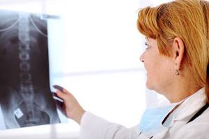 Артроз позвоночника: шейного, грудного и поясничного отдела