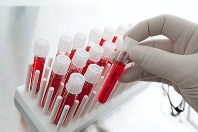 Как сдавать анализ на гормоны у женщин: как сдаются анализы, когда нужно, как правильно сдается кровь, как берут