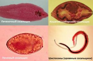 Все виды паразитов в организме человека (классификация)