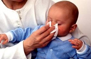 Сопли как вода у ребенка: чем лечить жидкий насморк, лечение, если течет нос ручьем