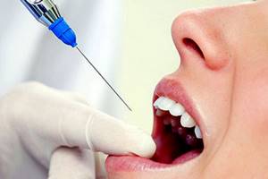 Можно ли лечить зубы во время беременности, лечение зубов беременным с анестезией