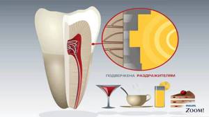 Как снять повышенную чувствительность зубов в домашних условиях: лечение очень чувствительных зубов