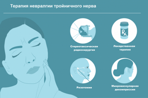 Воспаление тройничного нерва на лице: симптомы, лечение, можно ли вылечить в домашних условиях