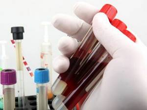 Можно ли определить рак по анализу крови: какие надо сдать чтобы выявить