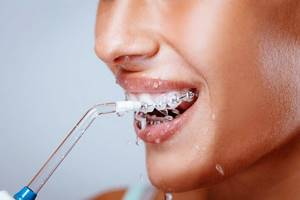 Что такое ирригатор полости рта и для чего он нужен, как выбрать ирригатор для зубов