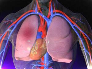 Инфаркт легкого: симптомы, пневмония легких, что это такое, причины