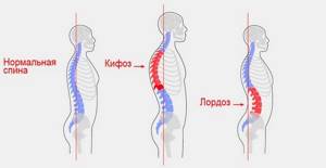 Сильная боль в желудке отдает в спину между лопаток: что это может быть, причины, боли в желудке и спине одновременно, в поясницу